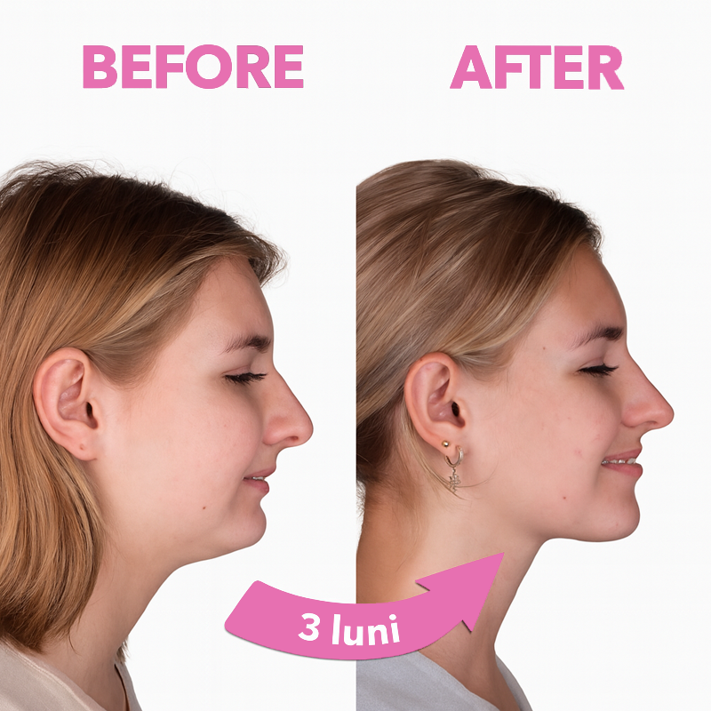 Queen Mouth Tape – Pentru somn